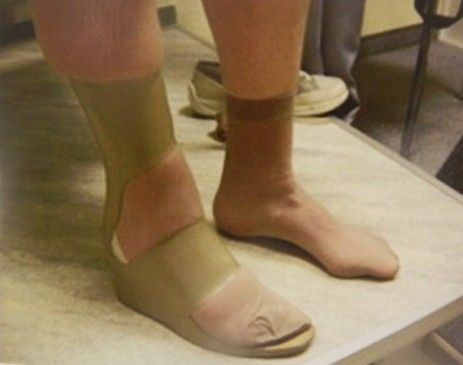 Innenschuhe aus der Orthopädiewerkstatt