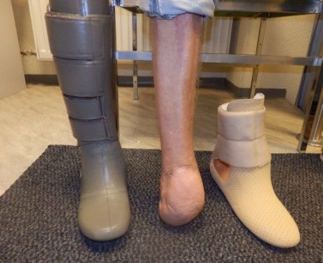 Innenschuhe aus der Orthopädiewerkstatt